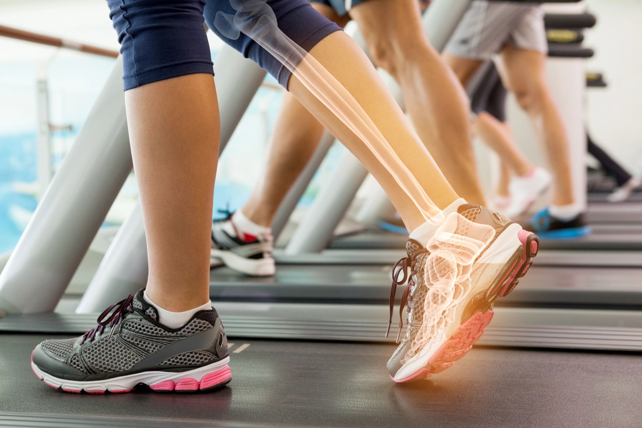 How do custom orthotics reduce foot pain and fatigue?
